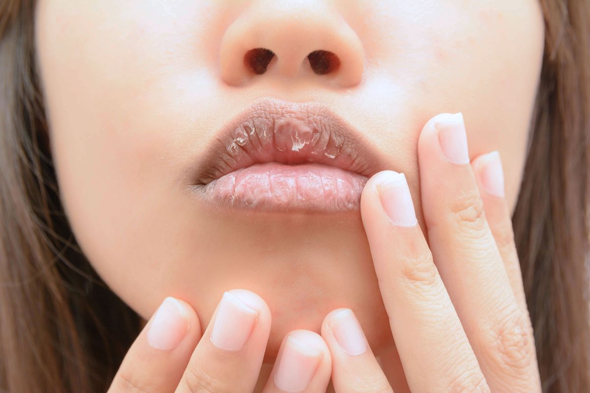 6 неща, които устните ви могат да ви кажат за вашето здраве